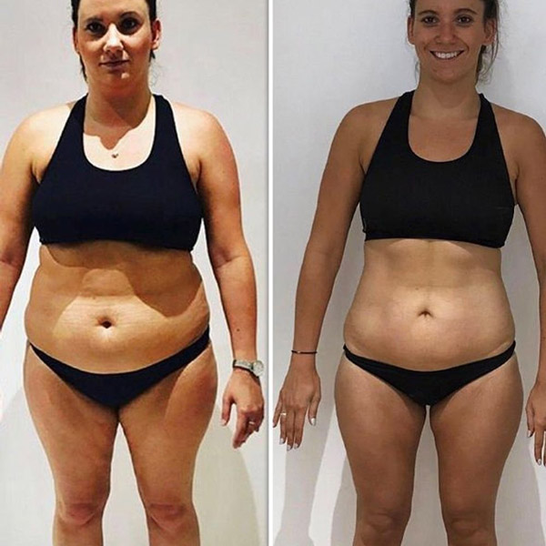 Mariana S 38anos antex e depois